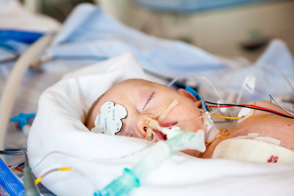 Difficult To Wean Of From Ventilator